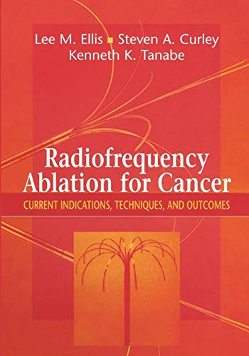 Radiofrequency Ablation For Cancer