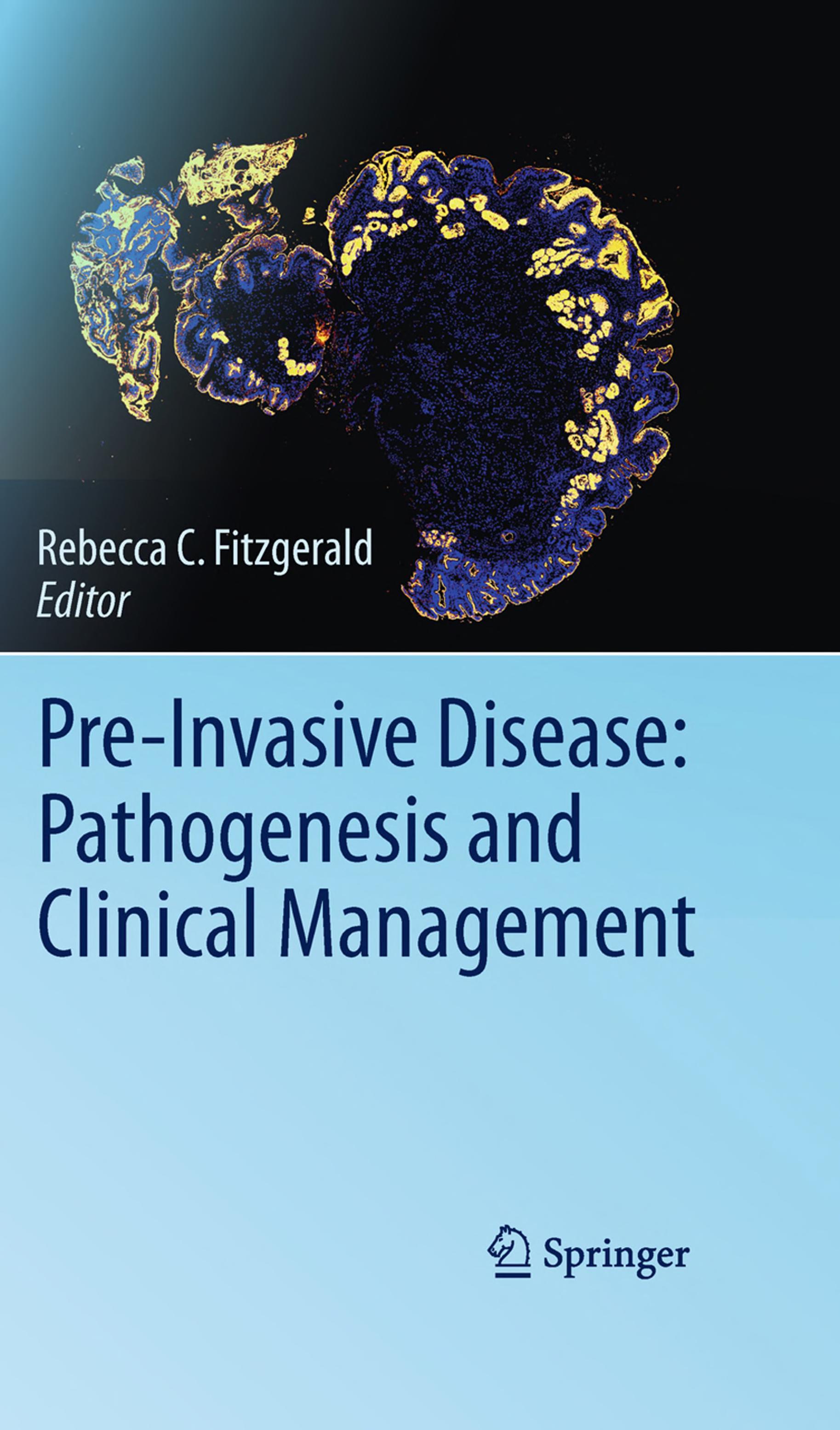 Pre-Invasive Disease