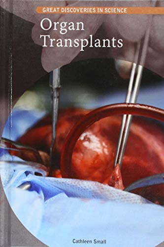 Organ Transplants