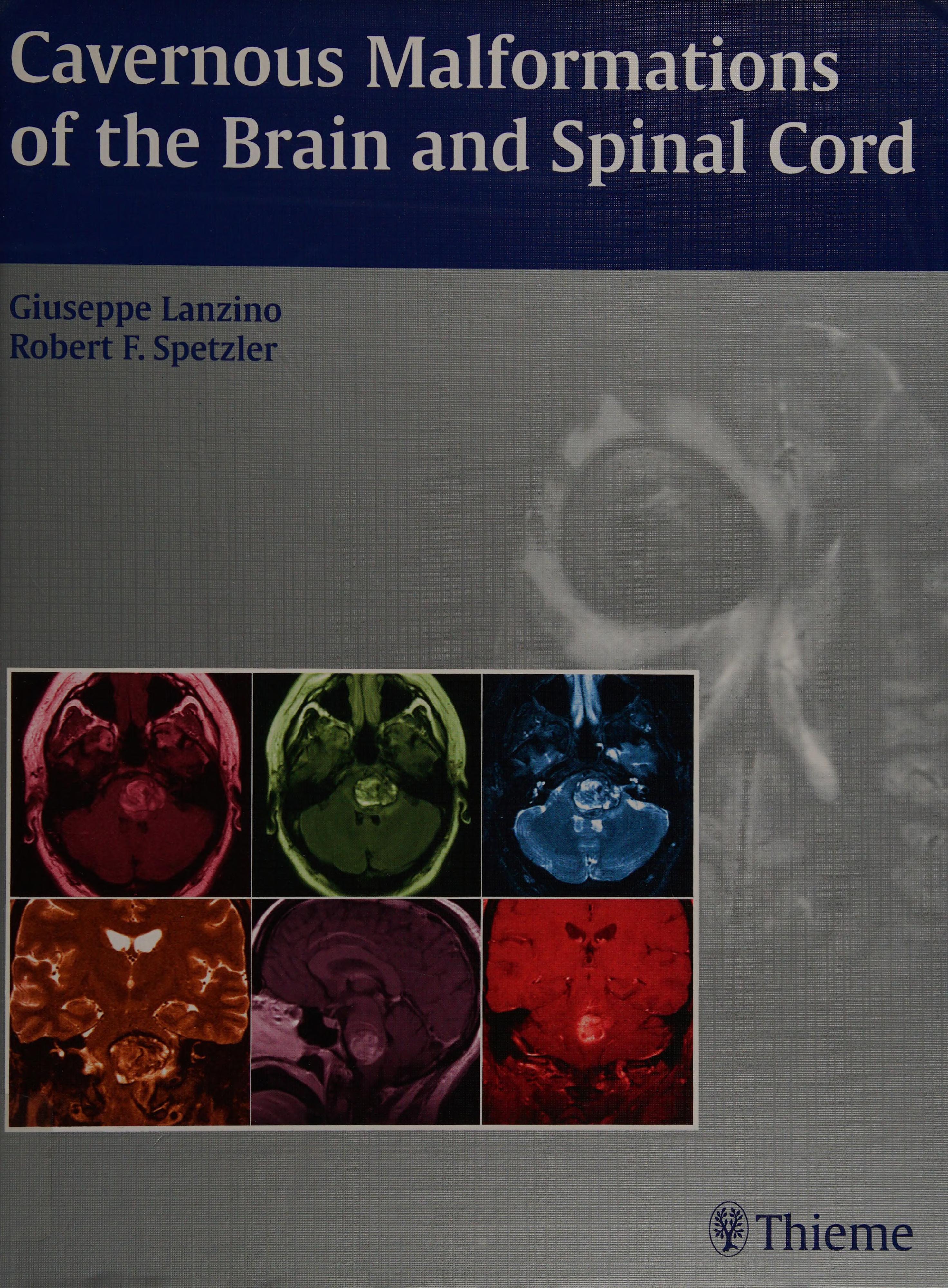 Cavernous Malformations of the Brain and Spinal Cord