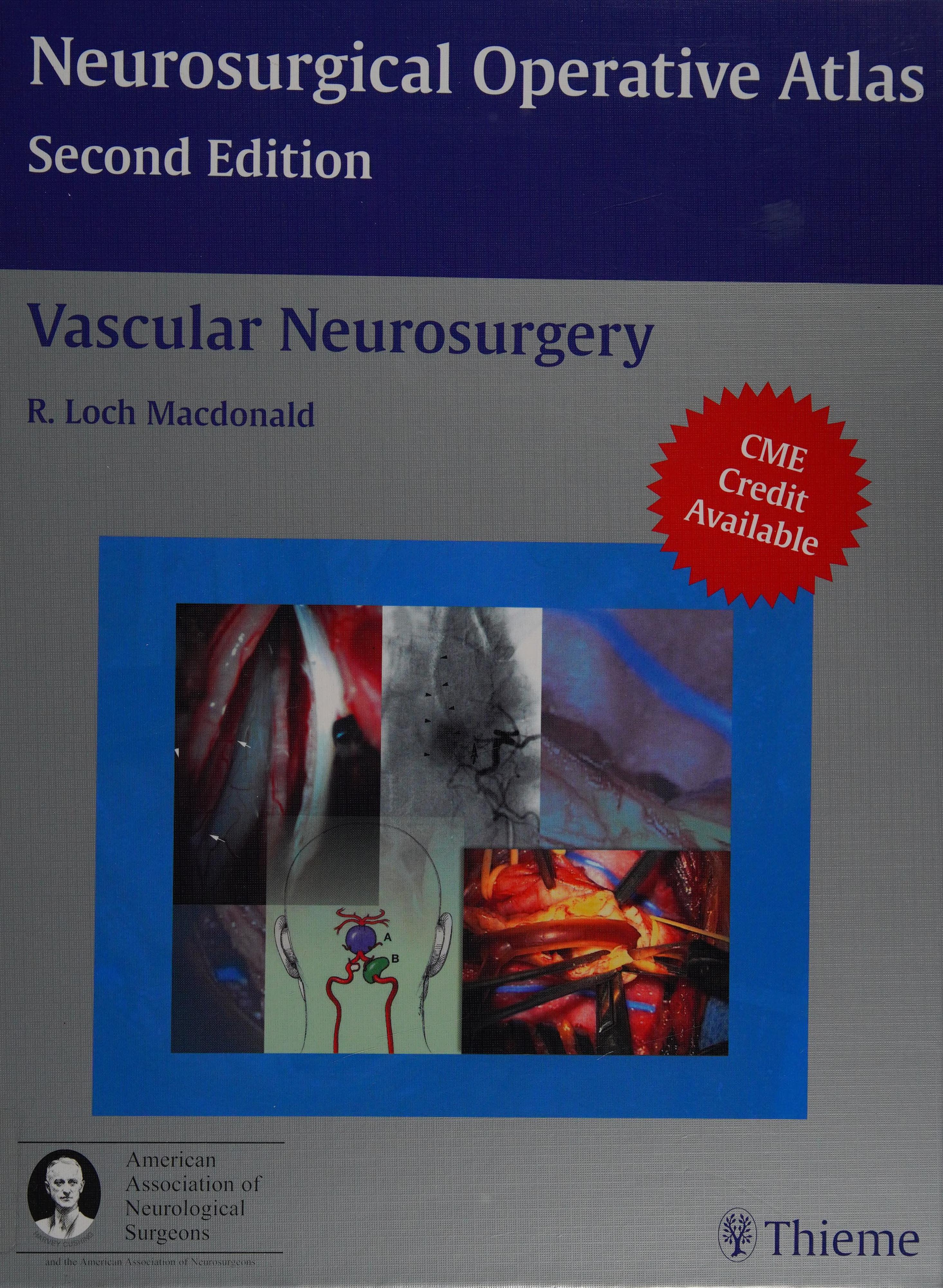 Vascular Neurosurgery