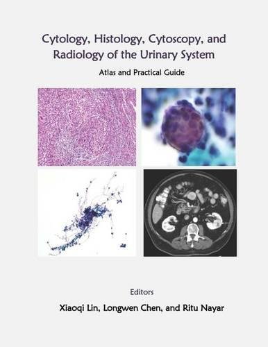 Urinary System
