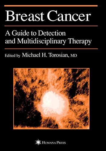 Breast Cancer: A Guide To Detection And Multidisciplinary Therapy