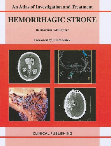 Hemorrhagic Stroke: An Atlas Of Investigation And Treatment