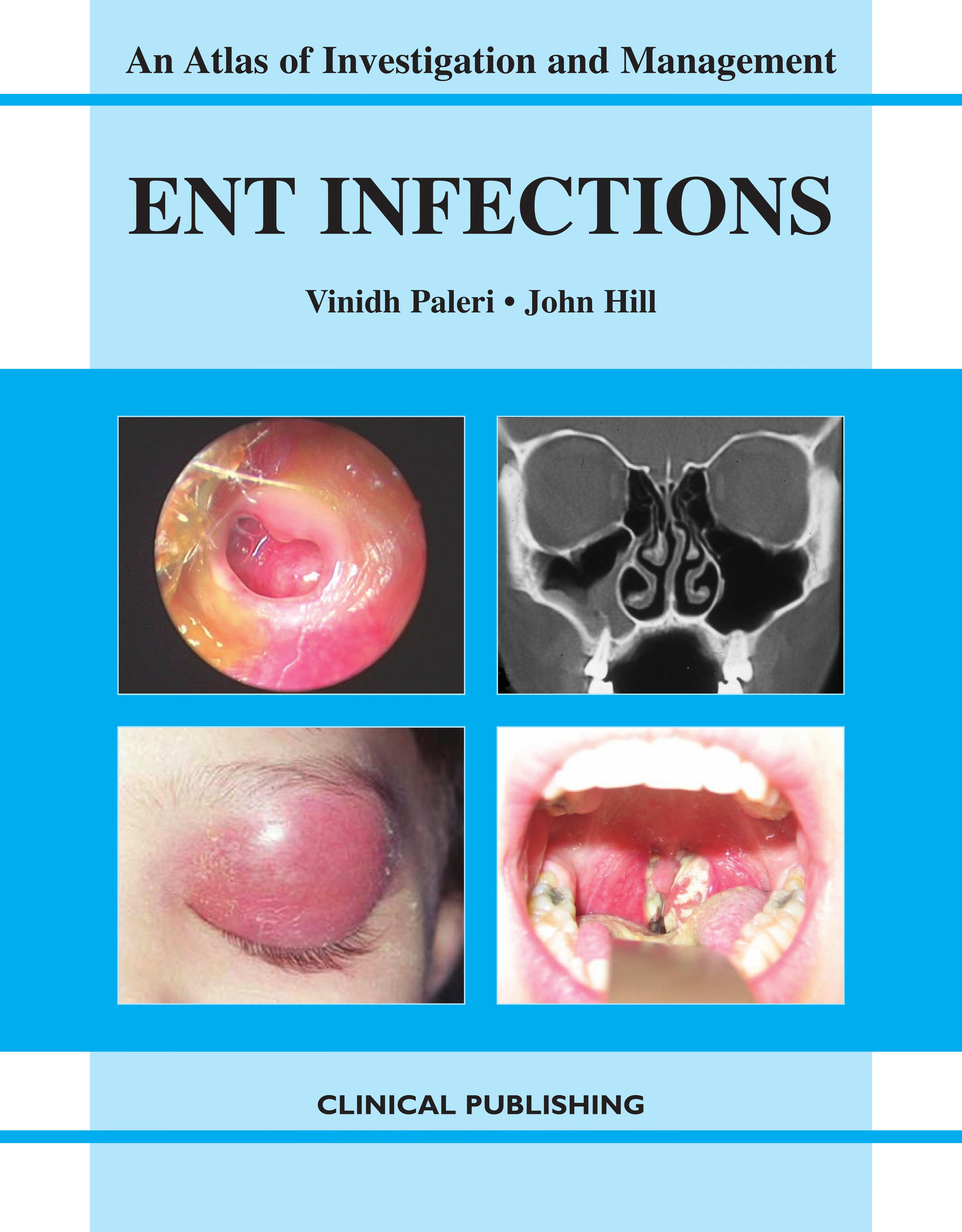 Ent Infections: An Atlas Of Investigation And Management