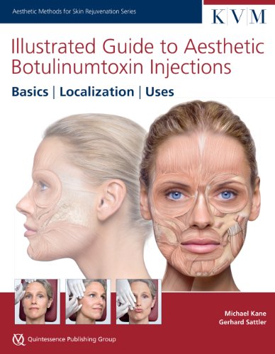 Illustrated Guide To Aesthetic Botulinum Toxic Injections
