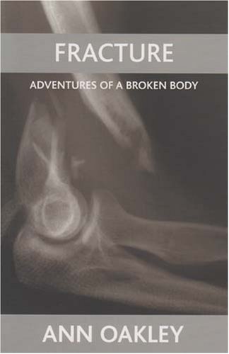 Fracture