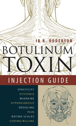 Botulinum Toxin Injection Guide
