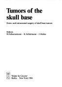 Tumours of the Skull Base