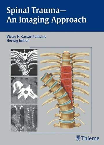 Spinal trauma: an imaging approach