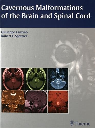 Cavernous malformations of the brain and spinal cord