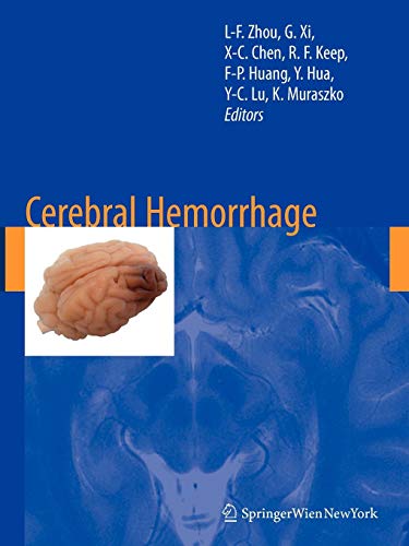 Cerebral Hemorrhage