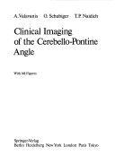 Clinical Imaging of the Cerebello Pontine Angle