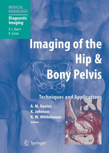 Imaging Of The Hip & Bony Pelvis: Techniques And Applications