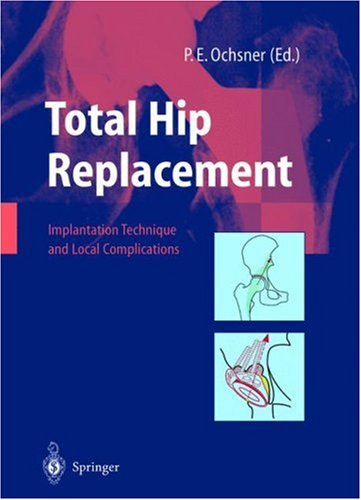 Total Hip Replacement: Implantation Technique And Local Complications