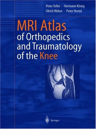 Mri Atlas Of Orthopedics And Traumatology Of The Knee