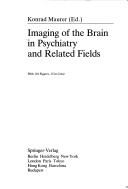 Imaging of the brain in psychiatry and related fields