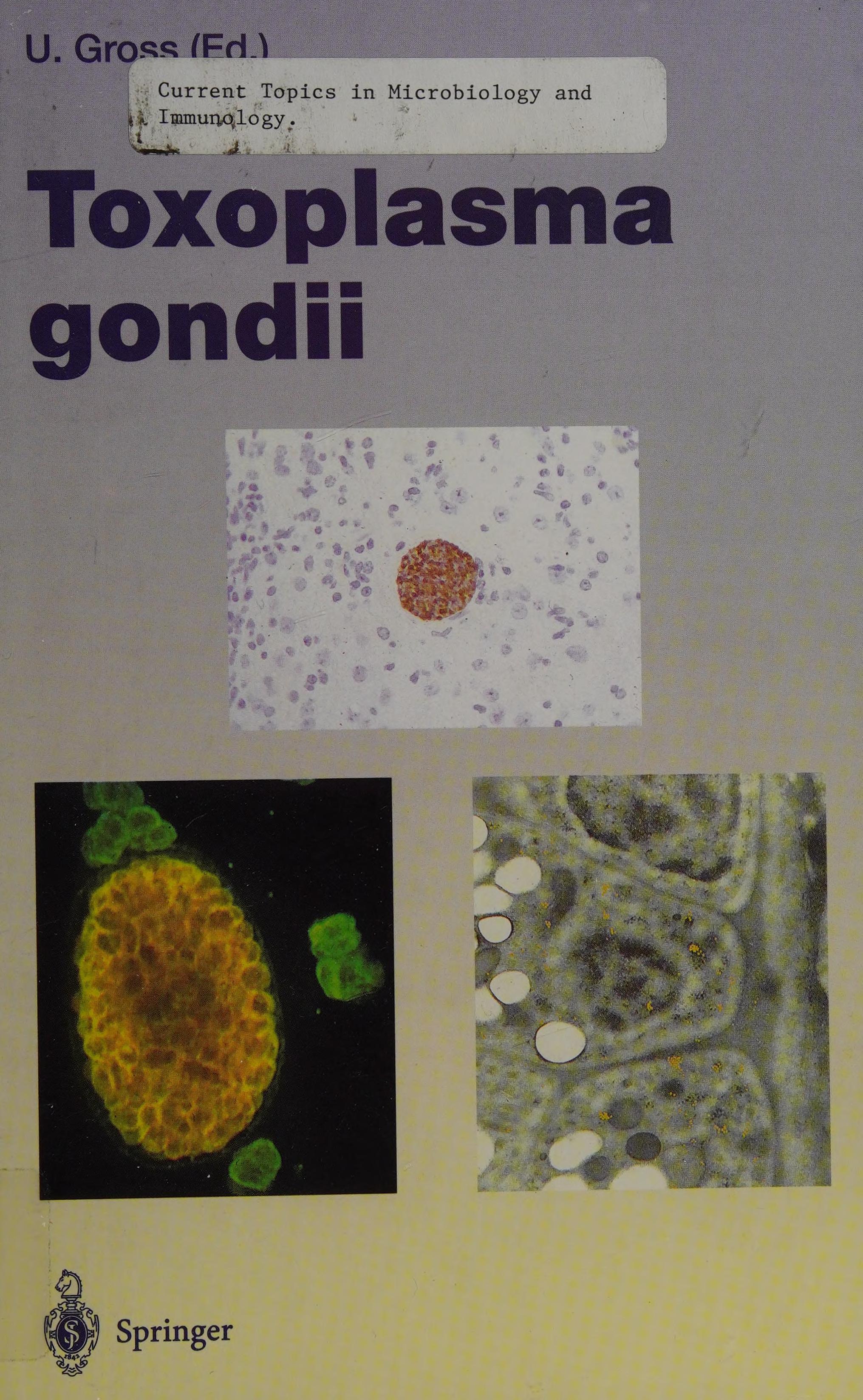 Toxoplasma Gondii