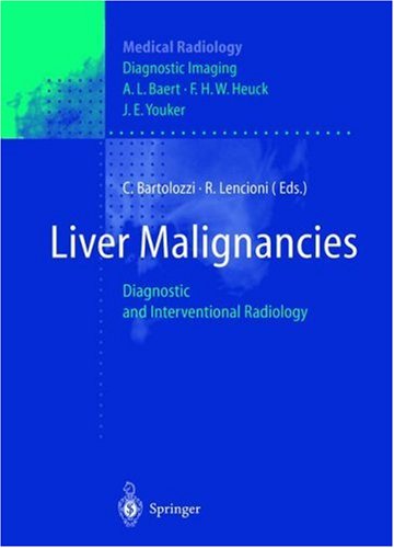 Liver Malignancies