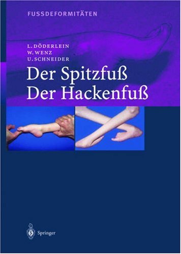 Fussdeformitäten