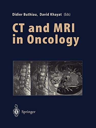 Ct and Mri in Oncology