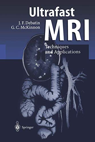 Ultrafast Mri