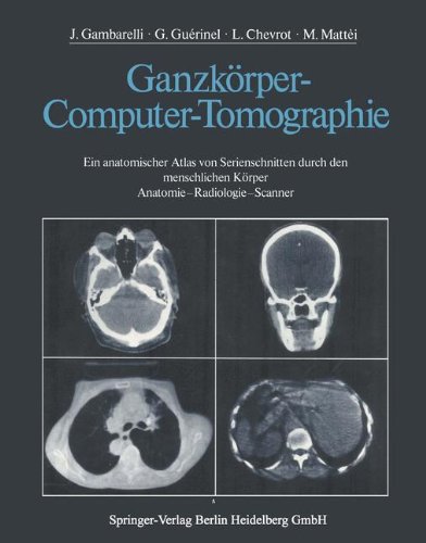 Ganzkörper-Computer-Tomographie