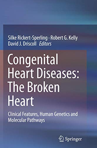 Congenital Heart Diseases The Broken Heart