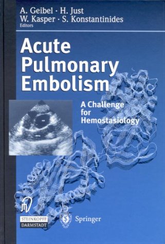 Acute Pulmonary Embolism