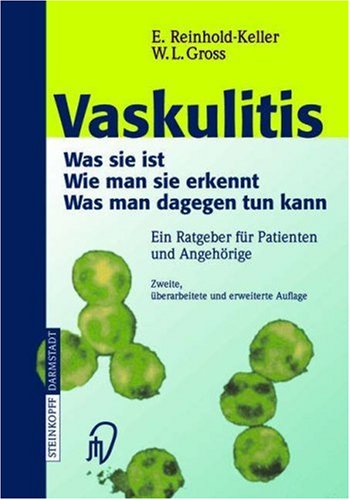 Vaskulitis: Was Ist Sie - Wie Man Sie Erkennt - Was Man Dagegen Tun Kann