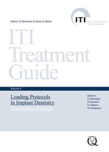 ITI Treatment Guide, Vol 4