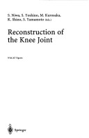 Reconstruction Of The Knee Joint
