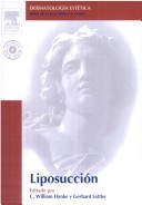 Sde: Liposuccion + Dvd