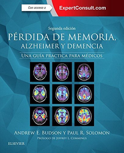 Perdida de memoria Alzheimer y demencia ExpertConsult