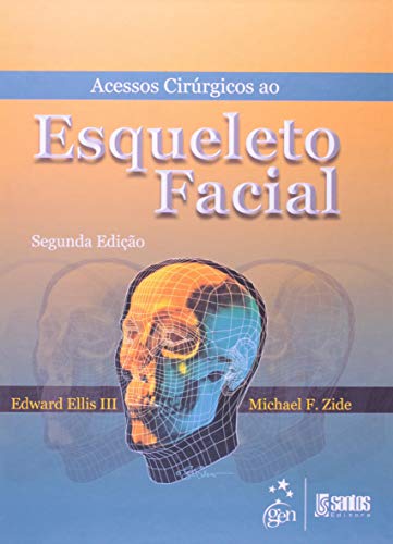 Acessos Cirúrgicos Ao Esqueleto Facial