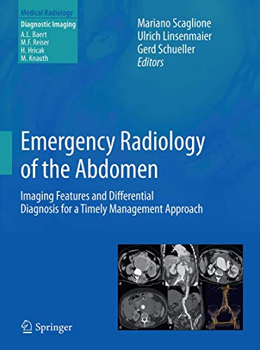Emergency Radiology Of The Abdomen: Imaging Features And Differential Diagnosis For A Timely Management Approach