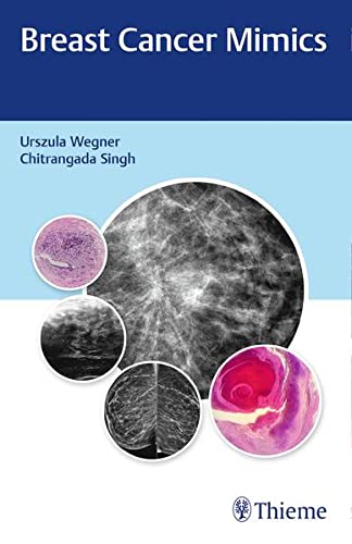 Breast Cancer Mimics 1st Ed.