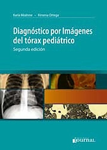Diagnostico Por Imagenes Del Torax Pediatrico