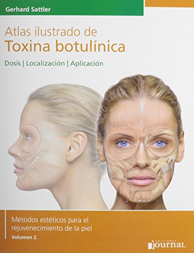 Atlas Ilustrado De Toxina Botulínica